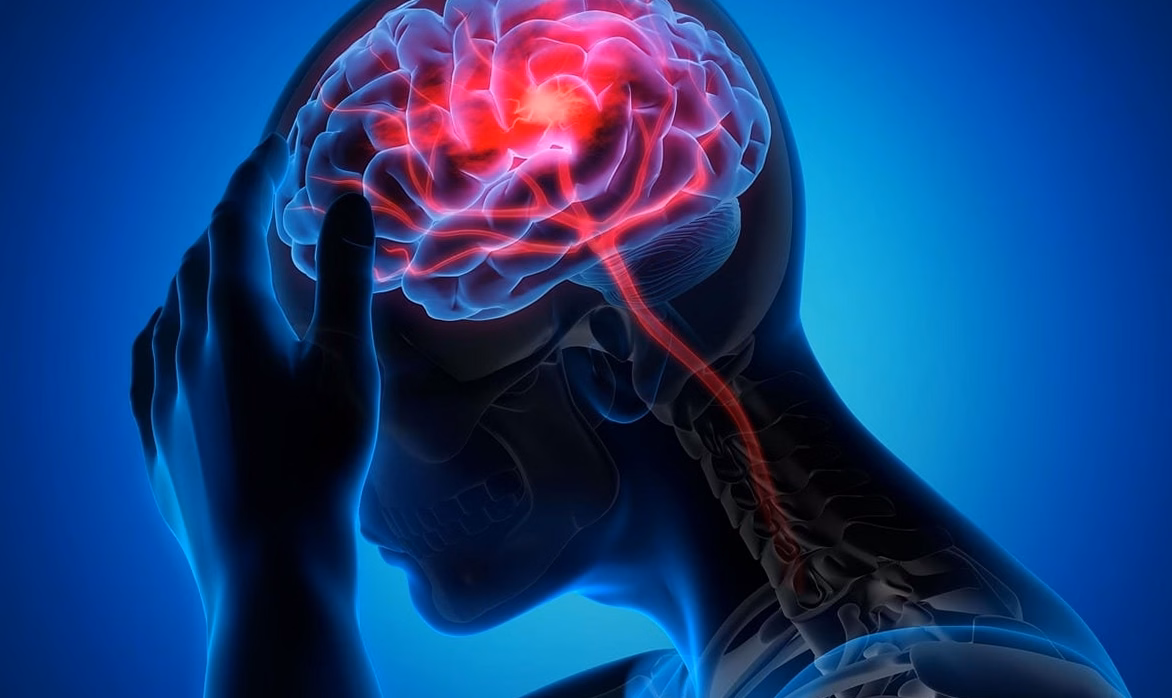 Crise d&rsquo;épilepsie cause : facteurs possibles et bilan